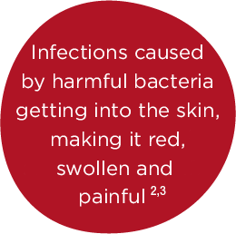 Infections caused by harmful bacteria getting into the skin, making it red, swollen and painful 2,3