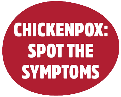 Chickenpox: Spot the symptoms