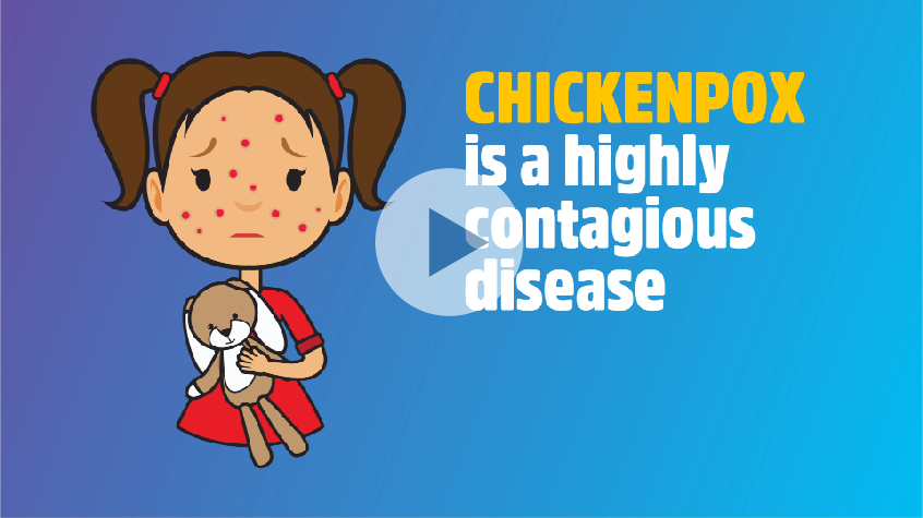 Video: Chickenpox is a highly contagious disease