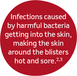 Infections caused by harmful bacteria getting into the skin, making the skin around the blisters hot and sore.
