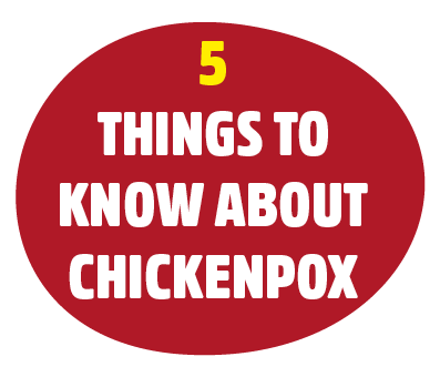 5 things to know about chickenpox. Download and share our 5 must-know facts about chickenpox.