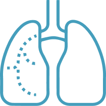 PULMONARER KRANKHEIT pneumokokken risiko